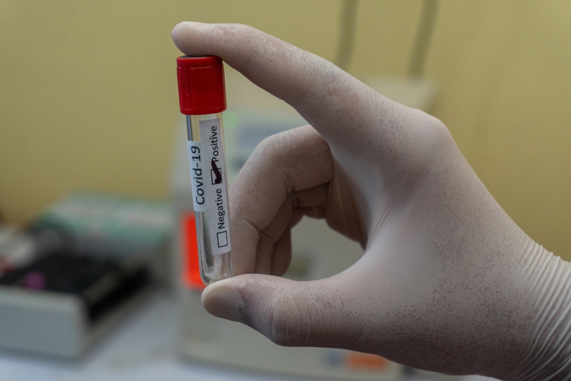 Number of Covid-19 cases continues to rise in Beijing; still high in Guangzhou, but declining