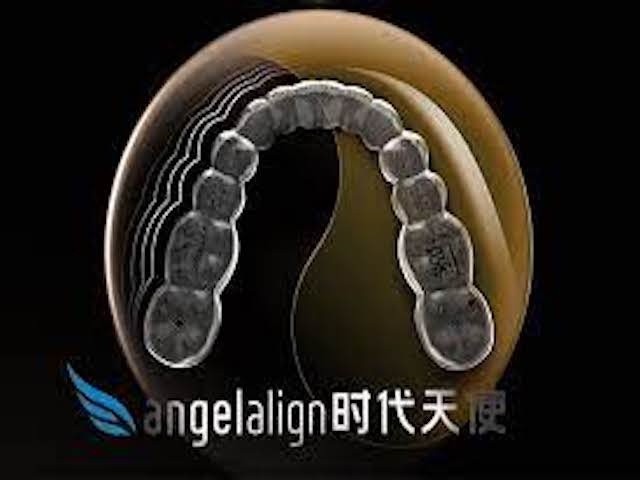 China's orthodontic market developing fast
